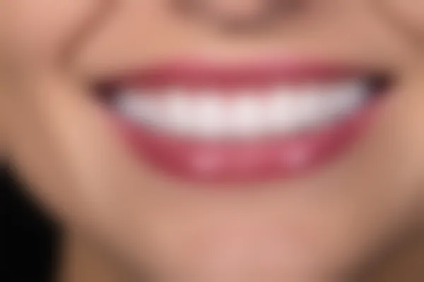 宜宾为笑口腔医院种植牙费用如何？2026年最新收费标准与服务解析