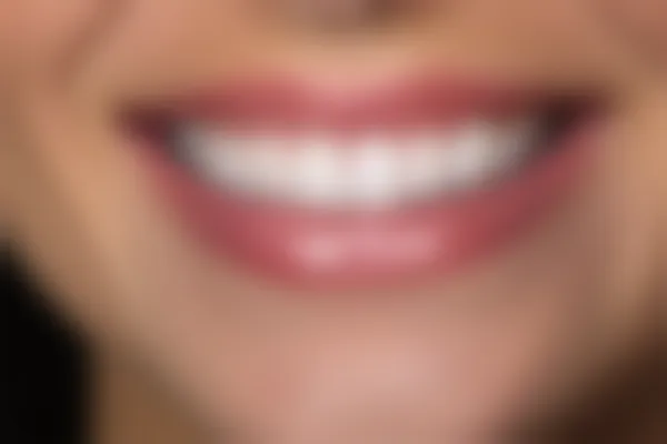 江西中寰口腔地包天治疗的收费标准为8000元起，现推出优惠价仅需6800元起，优异机会，赶快行动！