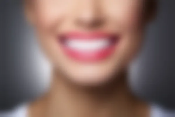 西安米兰柏羽口腔美容中心地包天收费原价6800元起，现优惠仅需4800元起，快来享受超值服务！