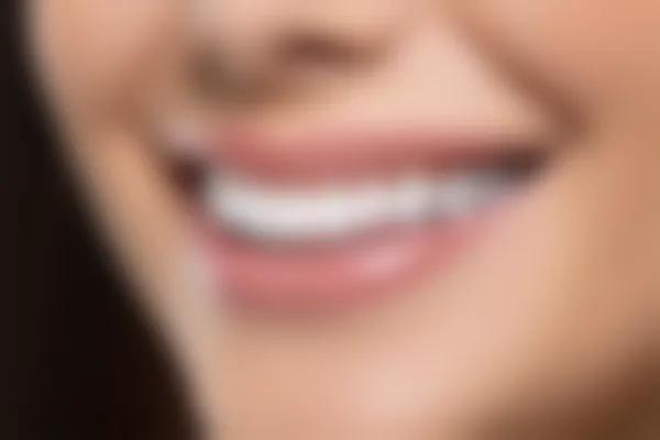 郑州妃她口腔门诊部现推出牙套优惠活动，原价3888元起，现仅需2999元起，限时促销，机会难得，赶快来享受超值服务吧！