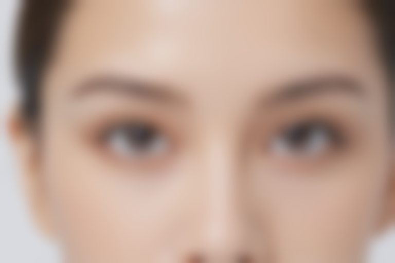 郴州瑞澜医疗美容医院双眼皮手术费用调整至3888元起，原价5000元起，优惠活动火热进行中！