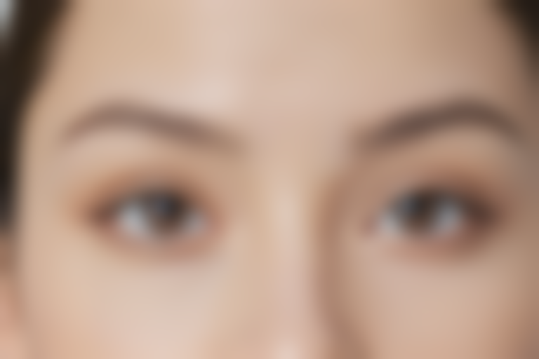 焦作雅典娜美容诊所眼袋去除价格表：原价4800元起，现优惠仅需3580元起！