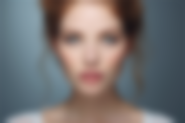 凹陷性疤痕的特征是什么？它对皮肤的影响有哪些？