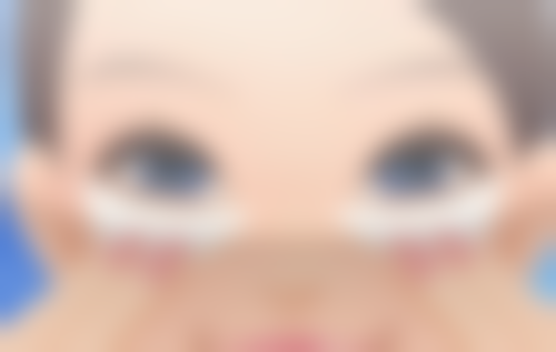 李建刚拉皮在成都素美医疗美容门诊做，无痕筋膜提升3.0技术，1.25万起自然又持久