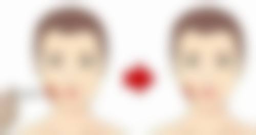 【李建刚拉皮效果篇】真人案例：33岁HR午休30分钟“换脸”