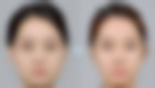 罗大鹏医生项目优势