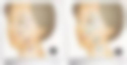 李明勋医生简介项目优势