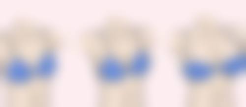 Sarah Kim医生做手术价格