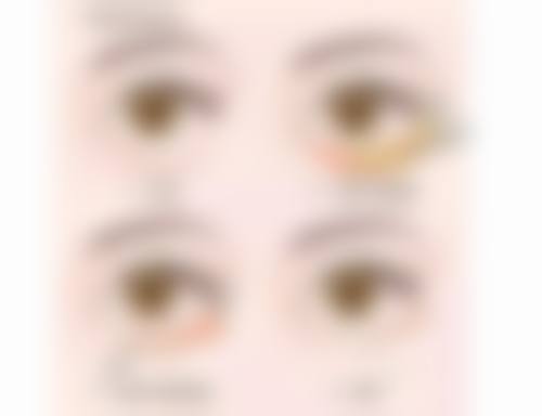 李明勋医生简介怎么挂号