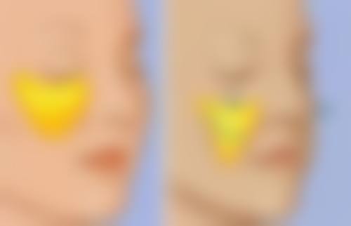 张慧媛医生简介之医生顾客实例图片