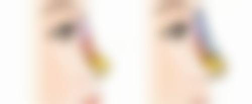 黄进伟医生口碑如何