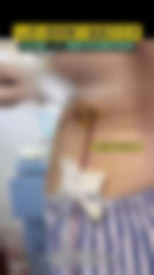 黄雄飞医生简介做手术价格