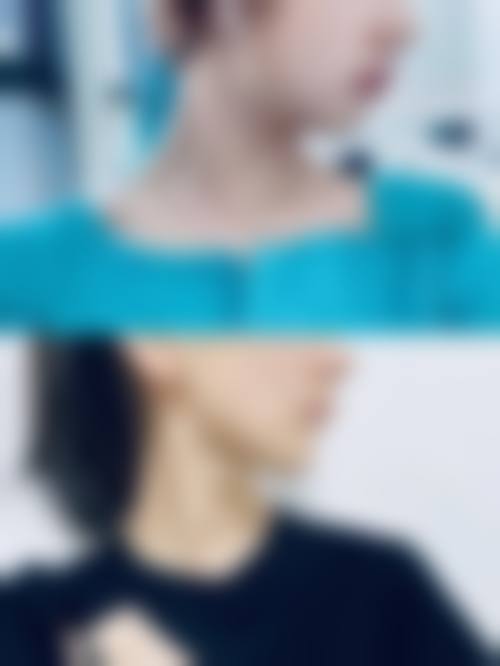 杨昕医生项目优势