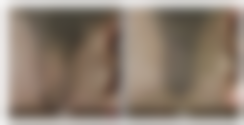 重庆时光焕发植发医院项目特色