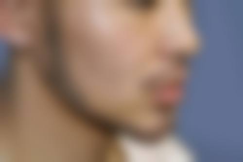 威海正源整形美容怎么样？抖音团购活动及价格表