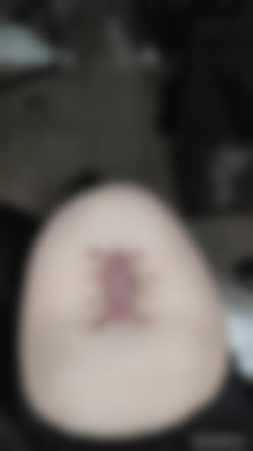 无锡坤如玛丽医学美容医院怎么样之口碑评价