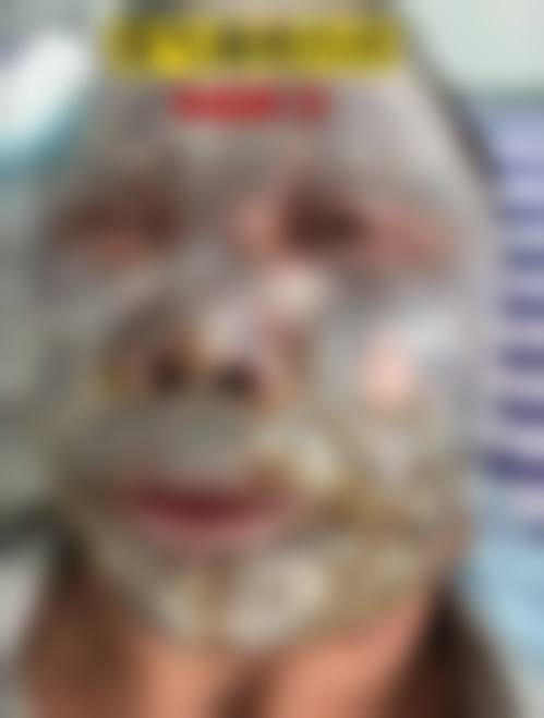 上海悦莱整形医院项目特色