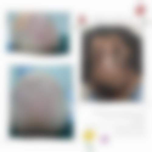 郭秀清医生简介之顾客实例图片情况