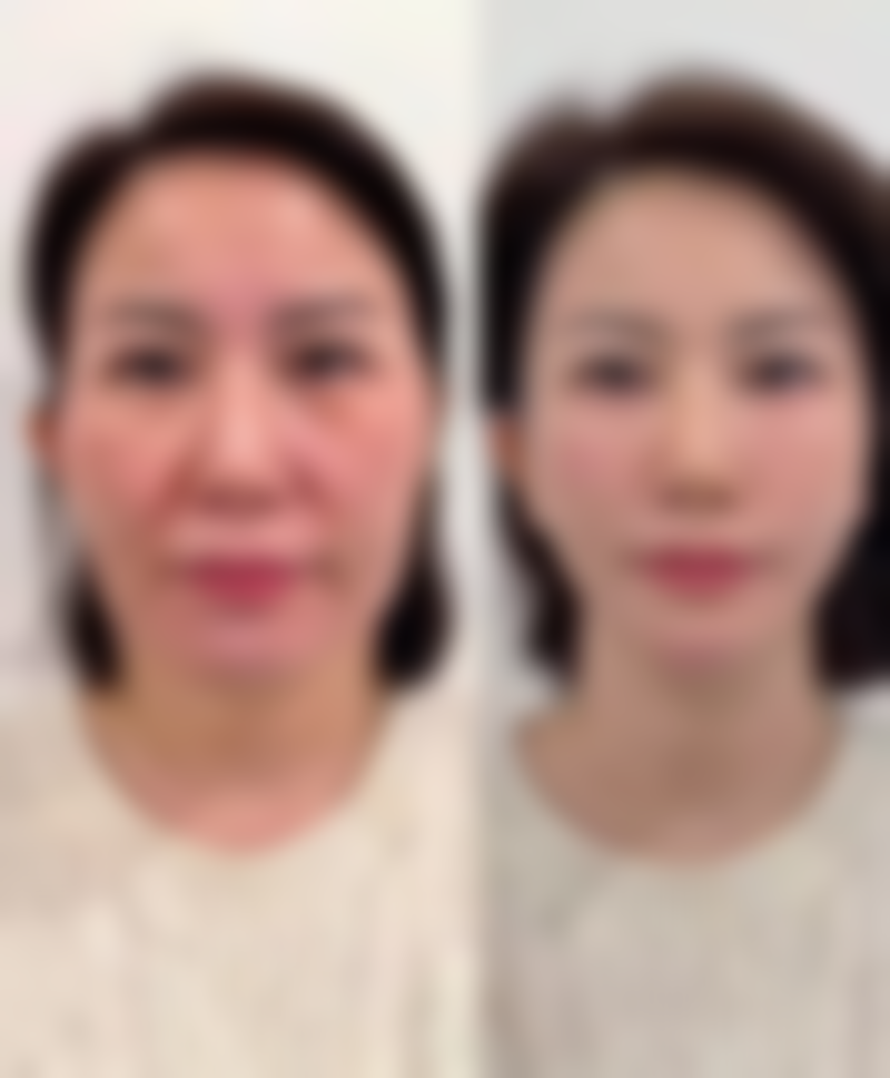 北京王府井整形医院价格表