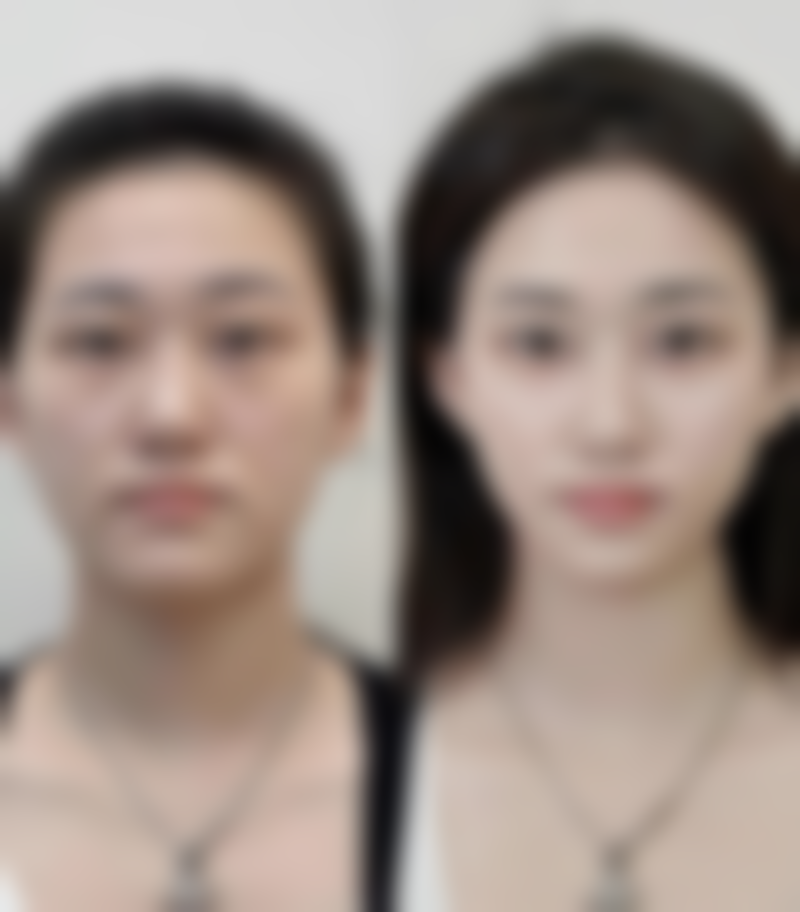 合肥丽人医院价格表