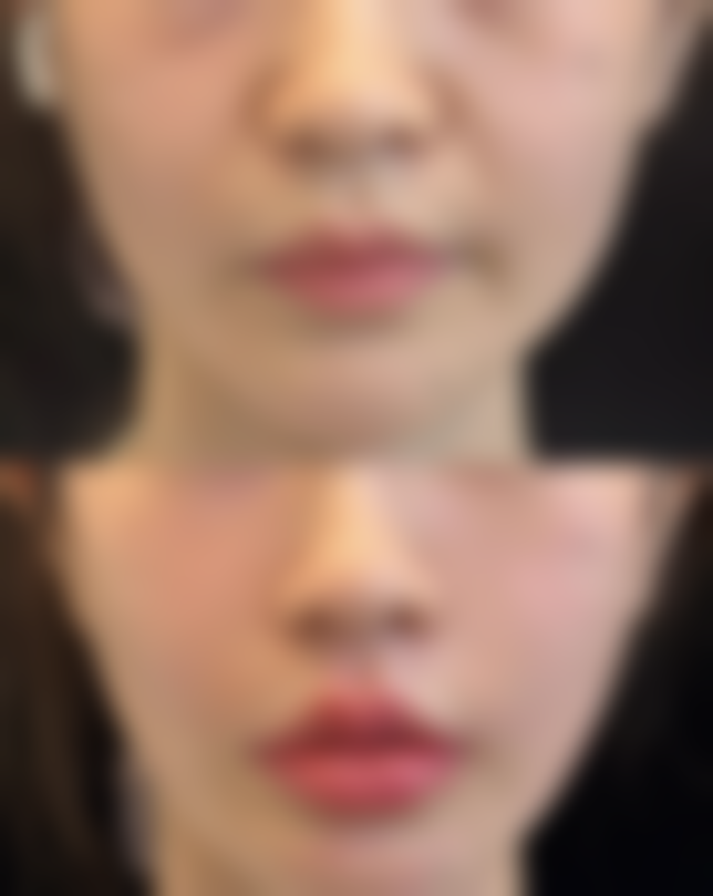 杭州临安君妍越妍医疗美容诊所评价