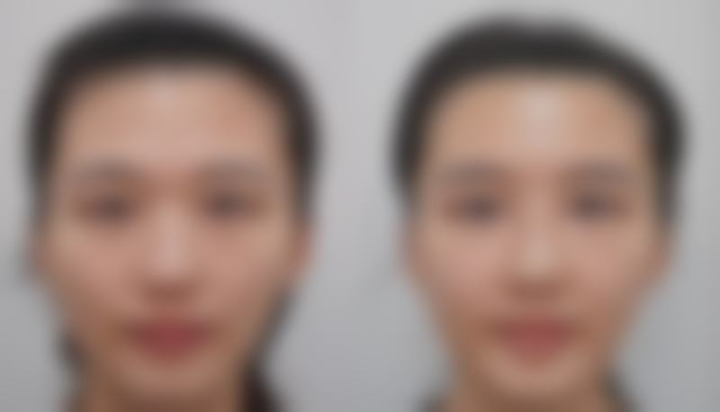 朱静医生简介做手术价格