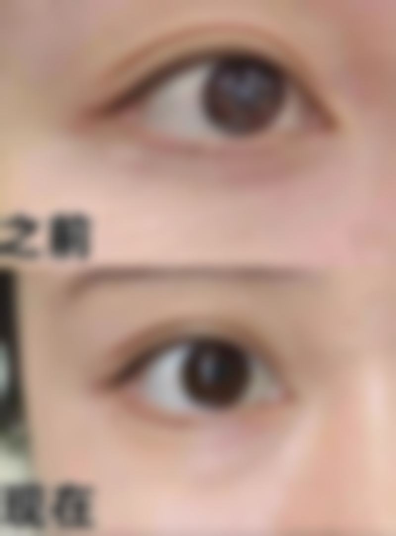 罗大鹏医生做手术价格