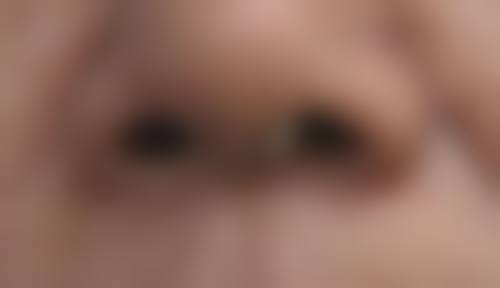 凯伦秀整形外科怎么样，正规吗？