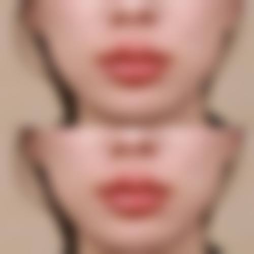 北京九号整形医院价格表