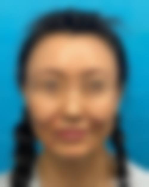 甘肃美联伊美医疗美容门诊部价格表