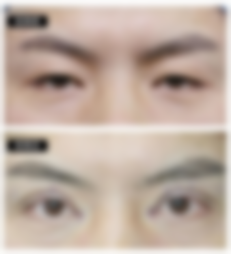 吉林华悦整形医院价格表