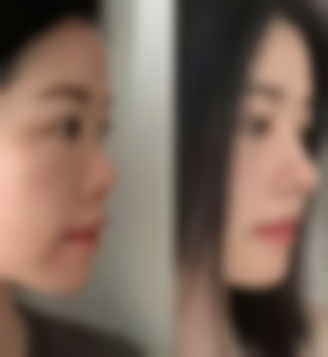 高岱佺医生简介做手术价格