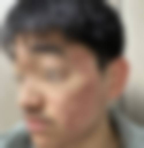 郑州市第一人民医院整形美容科项目特色