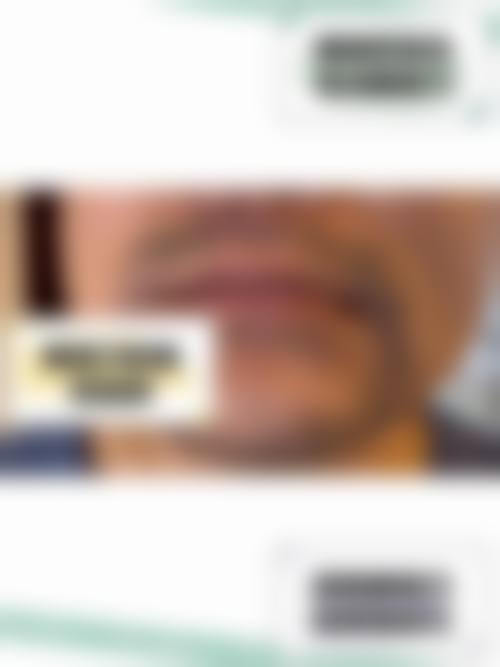 四、长沙新生植发医院怎么样——项目特色