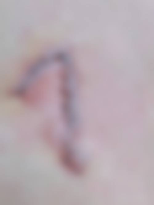 重庆五洲女子激光微整形美容医院价格表