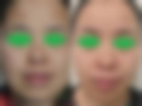 运城雅都美容整形门诊部价格表