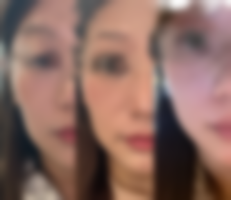 宁波海曙澳玛星光悦容整形医院口碑好不好？附真实患者口碑评价