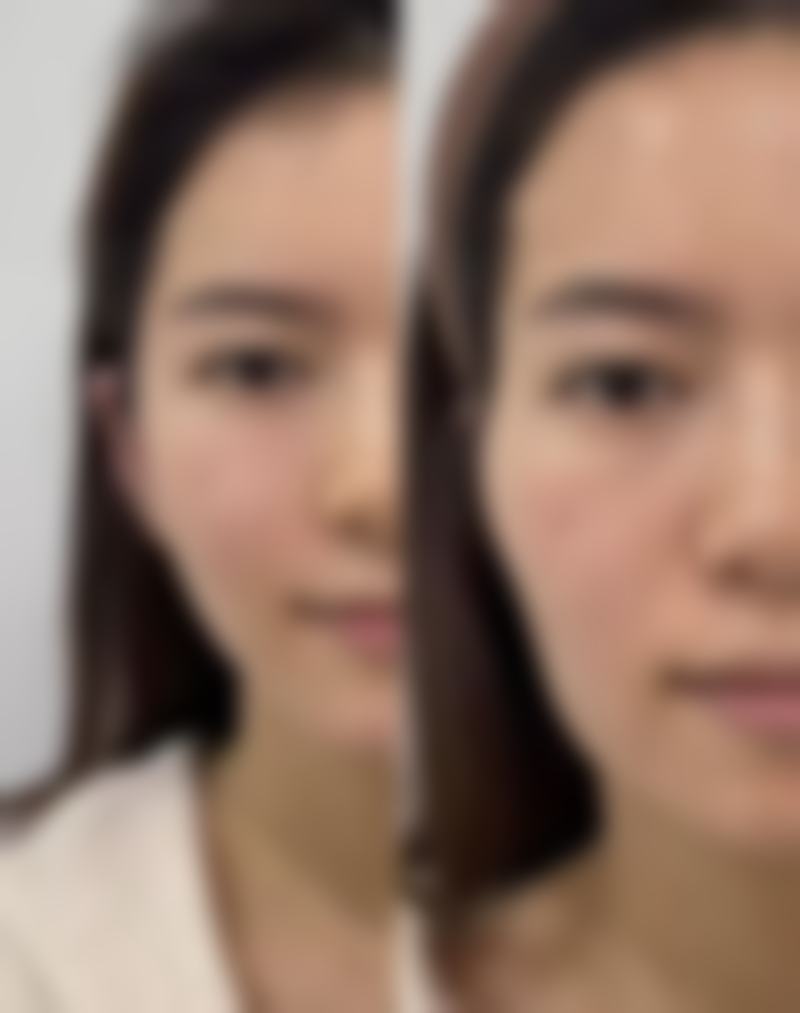 山西银黛医学整形美容医院口碑评价如何