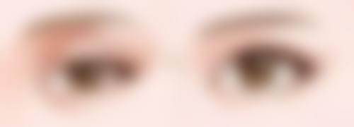 做了全切双眼皮以后眼皮会松弛吗