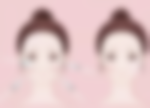 做了平行双眼皮以后眼皮会松弛吗