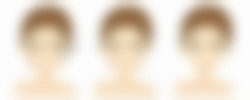 疤痕增生疙瘩用的祛疤膏成分分析