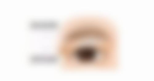 脸上有黑色疤痕怎么去除：手术治疗风险全方面评估