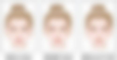 脸上有黑色疤痕怎么去除：国内有名祛疤医院具有影响力推荐