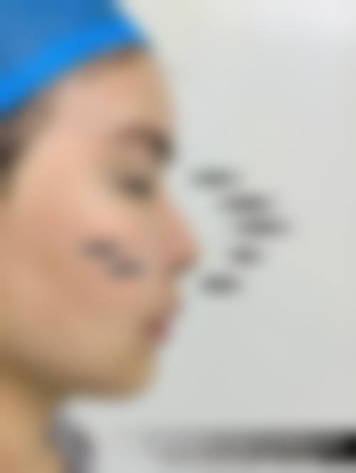 河南漯河缔莱美整形正规吗？怎么样