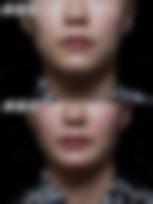 北京沃尔整形医疗美容诊所怎么挂号，地址在哪儿