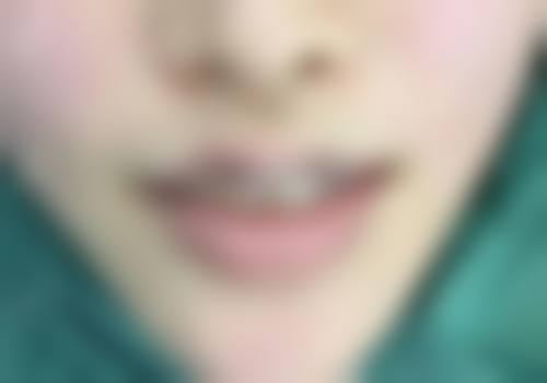 温州东华整形美容医院口碑评价如何