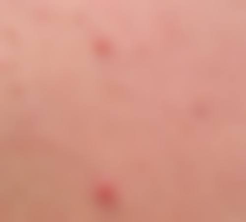 哈尔滨禾力康整形医院价格表