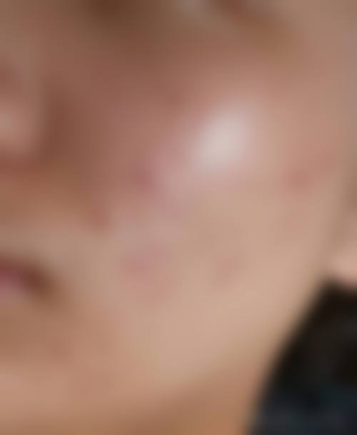 广州香凝整形医院口碑好不好？附真实患者口碑评价