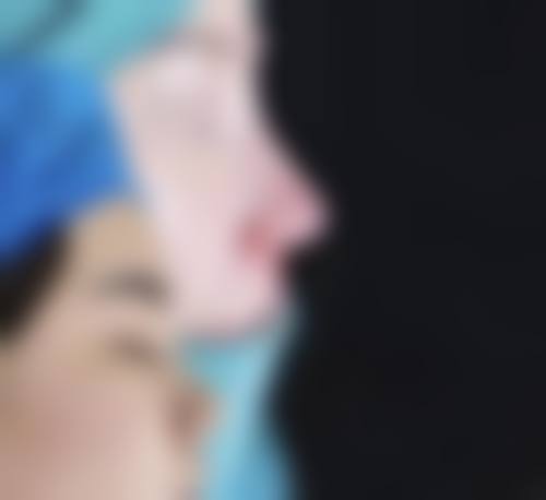 北京长虹医院整形科口碑好不好，附真实患者口碑评价