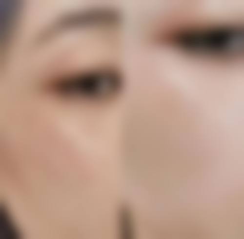 哈尔滨禾力康整形医院项目特色